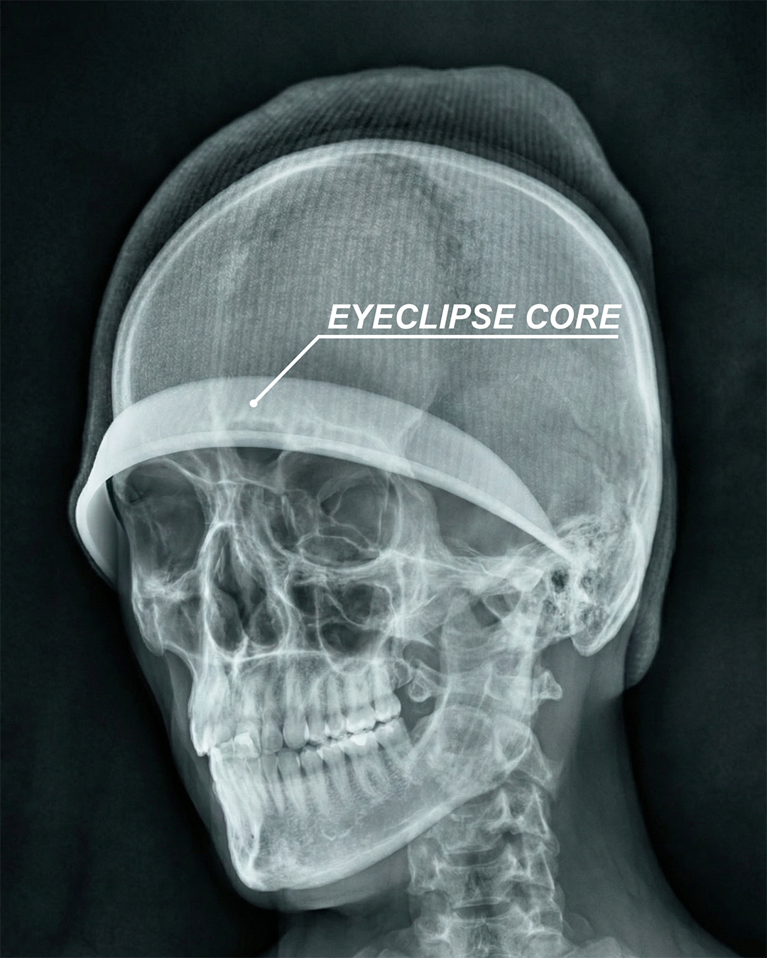 EYECLIPSE BEANIE - YOUTH ARCHIVES®